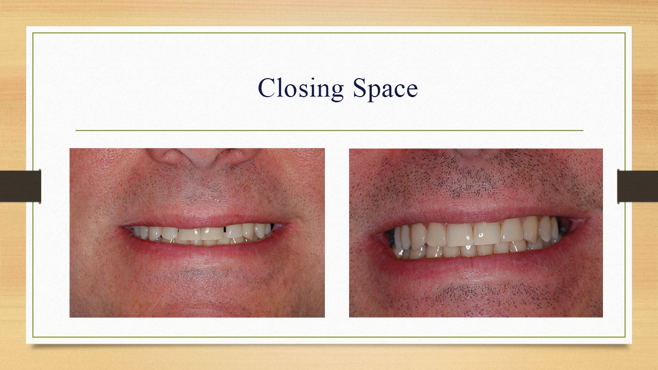 Kenneth W. Arida, DDS, PC | Oral Exams, Implant Dentistry and Night Guards