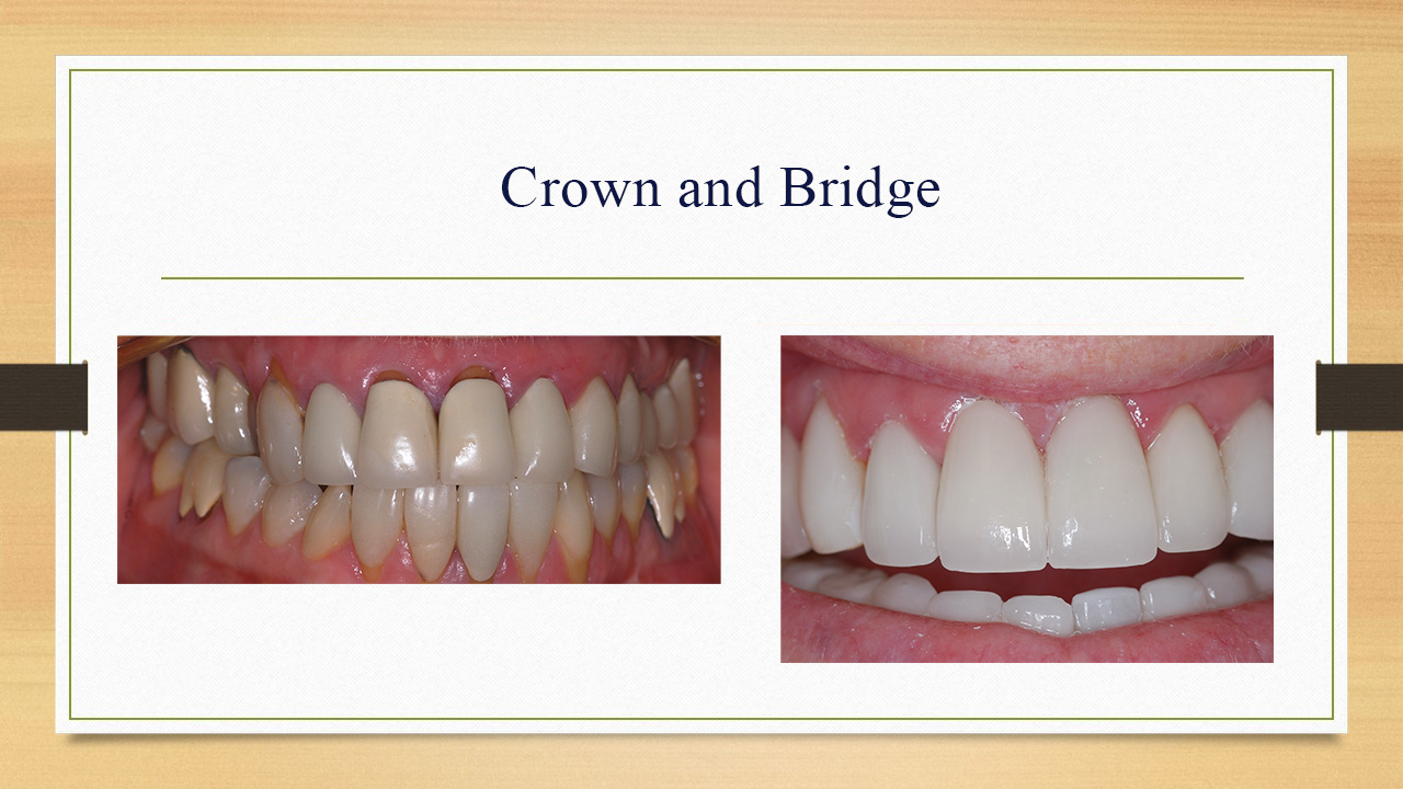 Kenneth W. Arida, DDS, PC | Dentures, Sedation Dentistry and Oral Exams