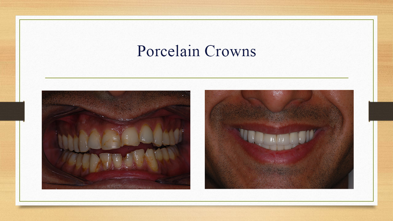 Kenneth W. Arida, DDS, PC | Implant Dentistry, TMJ Disorders and All-on-6