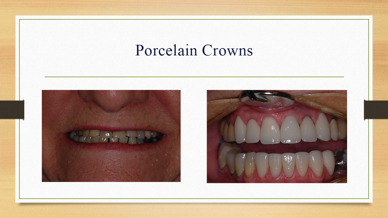 Kenneth W. Arida, DDS, PC | Crowns & Caps, Sedation Dentistry and TMJ Disorders