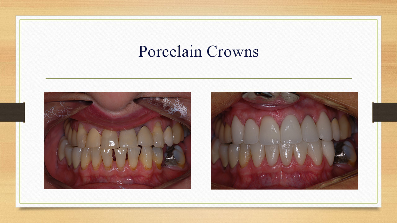 Kenneth W. Arida, DDS, PC | Extractions, Sleep Apnea and Emergency Treatment