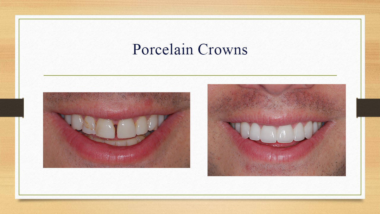 Kenneth W. Arida, DDS, PC | Periodontal Treatment, Sleep Apnea and Night Guards