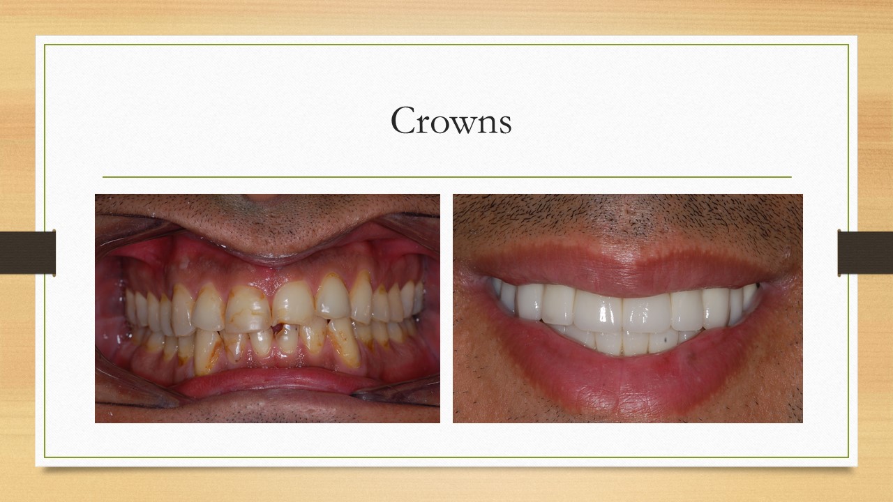 Kenneth W. Arida, DDS, PC | Teeth Whitening, TMJ Disorders and Preventative Program