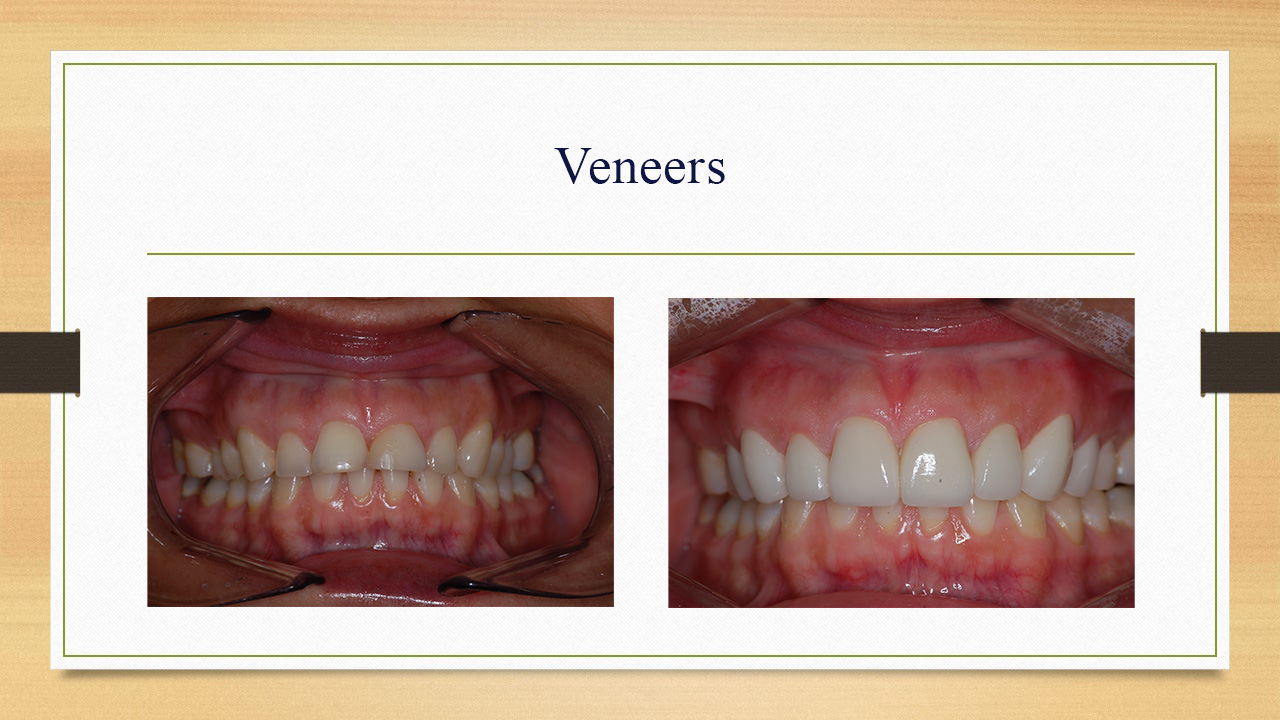 Kenneth W. Arida, DDS, PC | Oral Exams, Extractions and Preventative Program