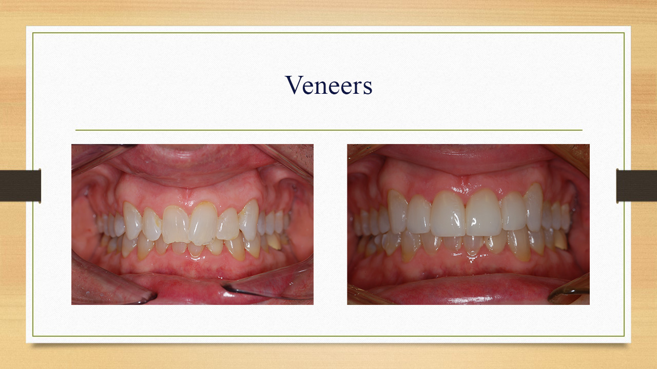 Kenneth W. Arida, DDS, PC | Oral Exams, Teeth Whitening and Pediatric Dentistry