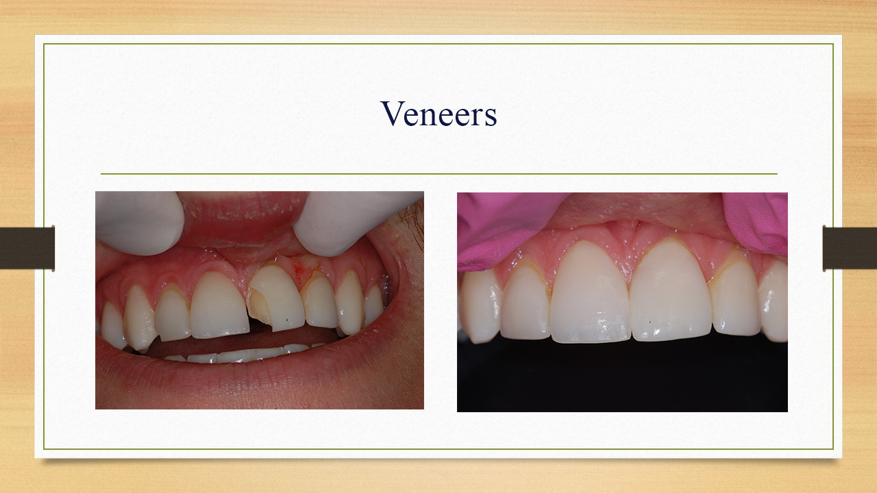 Kenneth W. Arida, DDS, PC | Crowns & Caps, Laser Dentistry and Pediatric Dentistry