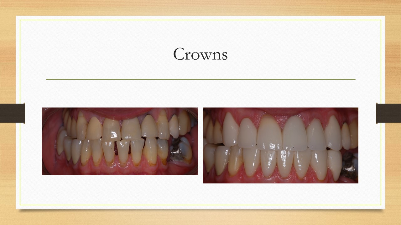 Kenneth W. Arida, DDS, PC | Pediatric Dentistry, LANAP reg  and Oral Cancer Screening