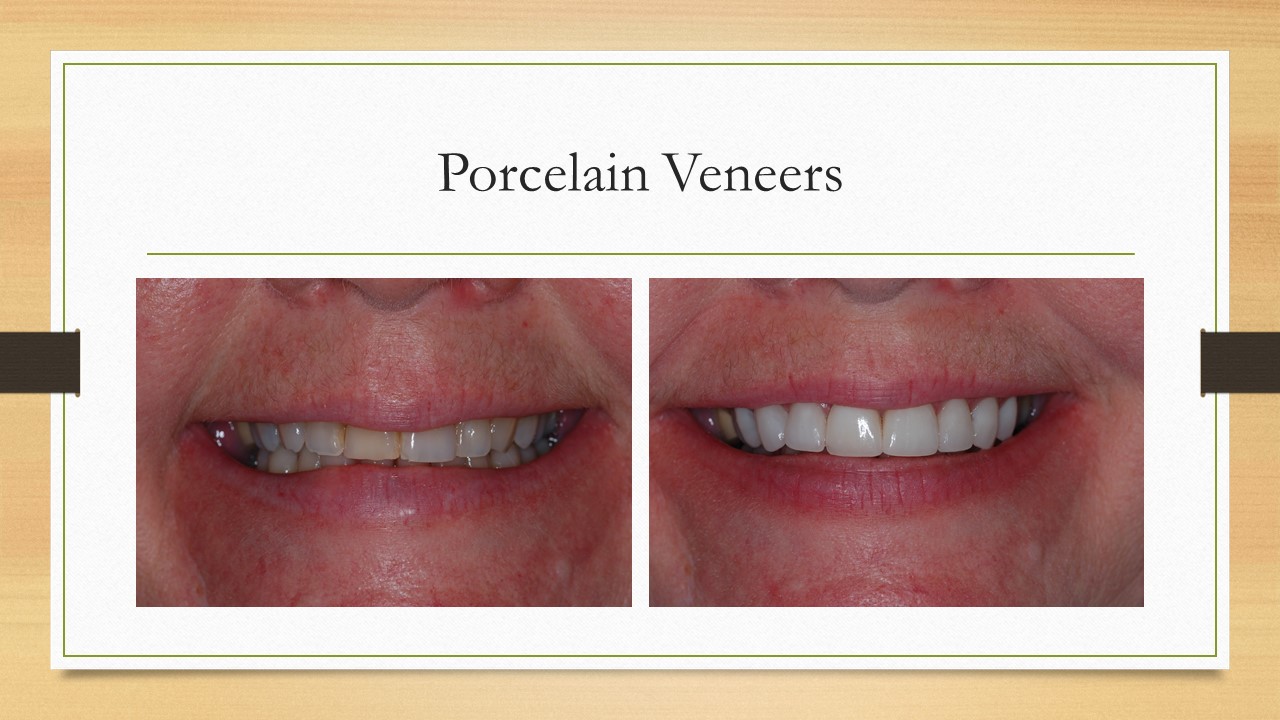 Kenneth W. Arida, DDS, PC | Cosmetic Dentistry, Sedation Dentistry and Sleep Apnea