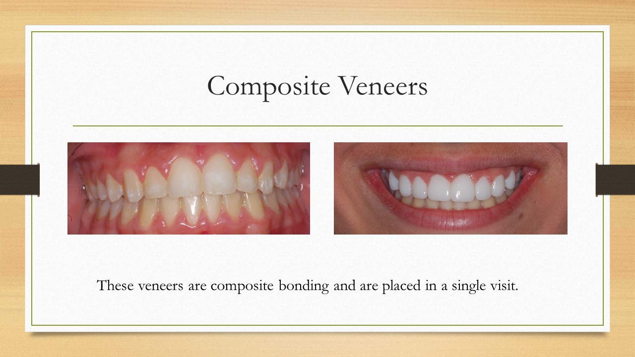 Kenneth W. Arida, DDS, PC | Preventative Program, Sedation Dentistry and Night Guards