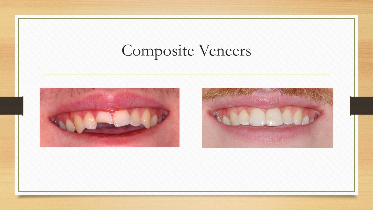 Kenneth W. Arida, DDS, PC | Cosmetic Dentistry, Invisalign reg  and Night Guards