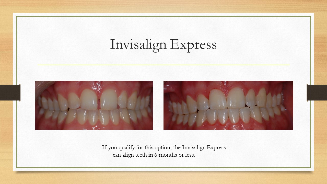 Kenneth W. Arida, DDS, PC | Digital Radiography, Veneers and Oral Cancer Screening