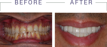 Kenneth W. Arida, DDS, PC | Emergency Treatment, Oral Cancer Screening and Night Guards