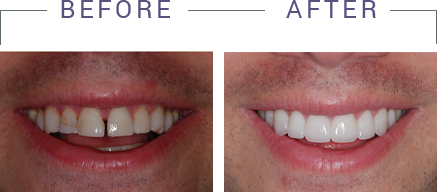 Kenneth W. Arida, DDS, PC | Sports Mouthguards, Periodontal Treatment and Oral Exams